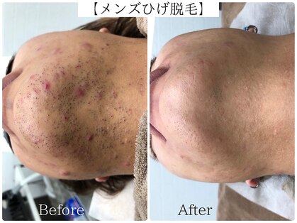 スマイルビューティラボ 別府店(Smile Beauty lab.)の写真