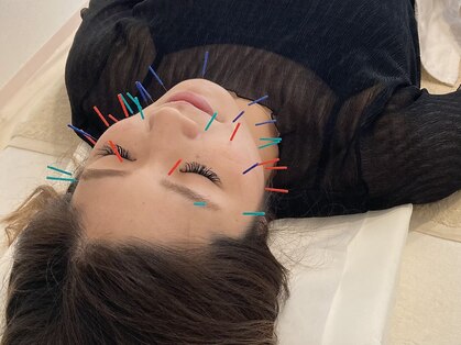 柚香鍼灸院の写真