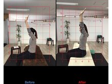 ストレチックス 近江八幡店/首・肩に痛みがあった女性