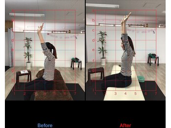 ストレチックス 近江八幡店/首・肩に痛みがあった女性