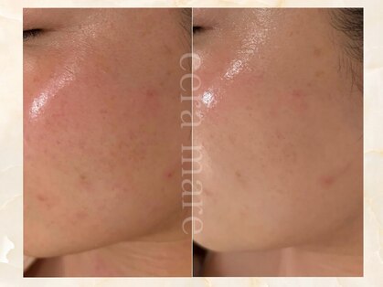 セーラマーレ(cera-mare Esthetic by CARDIA)の写真