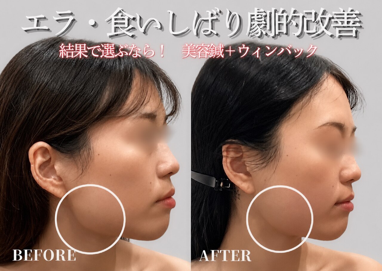 ミプラス鍼灸スタジオ｜ホットペッパービューティー