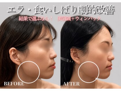 ミプラス鍼灸スタジオの写真