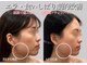 ミプラス鍼灸スタジオの写真