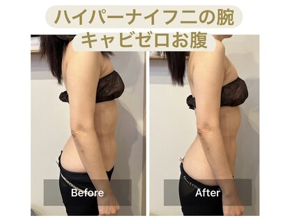 ビボーン ボディ(美bone body)の写真