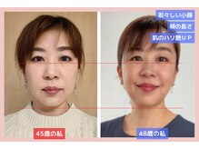 サロン アンドケー(Salon&K)の雰囲気（中四国初！小顔調整×骨格調整）