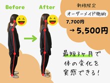アロゼ