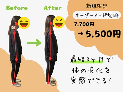 アロゼの写真