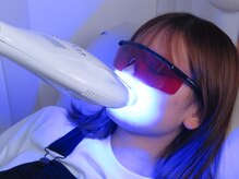 ホワイトニング ショップ 金沢店/スピーディ！ホワイトニング