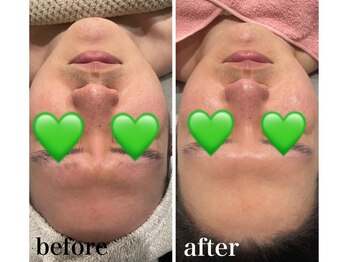 ジョアアンジェ 京橋店(joie ange)/毛穴が目立たないお肌に！