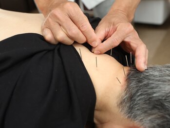 こさつ鍼灸治療院/