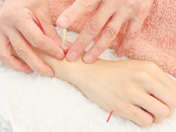 鍼灸治療院ヒカリ(hikari)/【鍼灸】３．施術