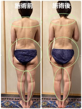 ローズ 下松(ROSE)/【肩の盛り上がりがスッキリ！】