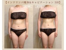 オキシー グレイス 黒崎店(OXY Grace)/ブライダルでご来店のお客様♪