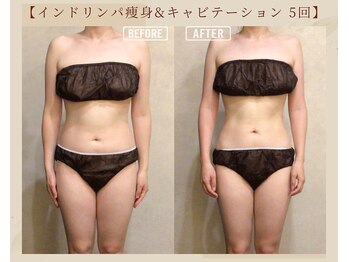 オキシー グレイス 黒崎店(OXY Grace)/ブライダルでご来店のお客様♪