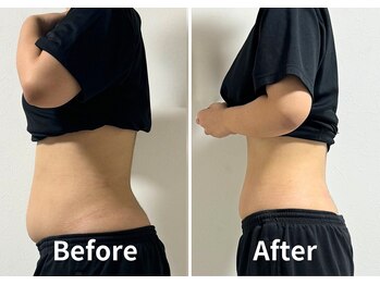 サンク(Cinq)/腸もみ/リンパマッサージ