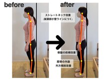エクセル 名古屋駅店(excel)/姿勢のビフォーアフター