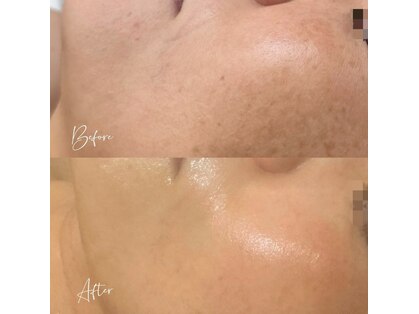 アピール(Appeal)の写真