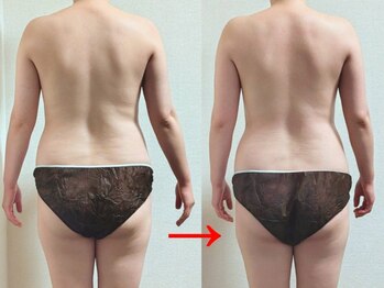 ソアン(Soan)/人気の全身コース