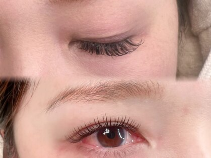 リム(Lim)の写真