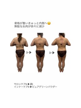 シャルム(Charme)/リヴァイセルボディ