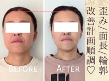 スウ(suu.)/Before-After【40代】9 回