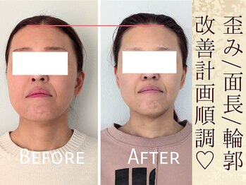 スウ(suu.)/Before-After【40代】9 回