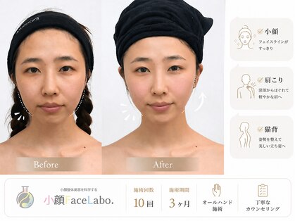 小顔フェイスラボ 栄店(小顔Face Labo.)の写真