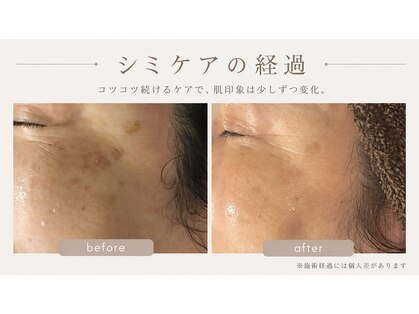 ジュネラ ボーテ(Jenela beaute)の写真