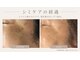 ジュネラ ボーテ(Jenela beaute)の写真