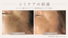 ジュネラ ボーテ(Jenela beaute)