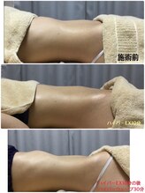 ペリー(PELLY)/ハイパーウェーブ