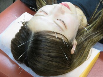 かねこ鍼灸接骨院/【美容鍼】リフトアップコース