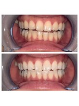 ライトビューティー 池袋店(LightBeauty)/症例写真