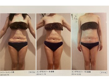 シェリール(Cherir)/エンダモロジー