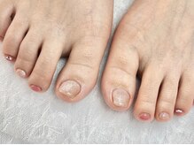 スピネイル(Spinail)/