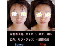 美容矯正サロン レレポノ(LELEPONO)/