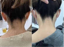 ミース 北九州店/うなじ★ビフォーアフター