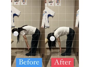 ナオル整体 宮崎院(NAORU整体)/20代女性施術事例【腰痛改善】