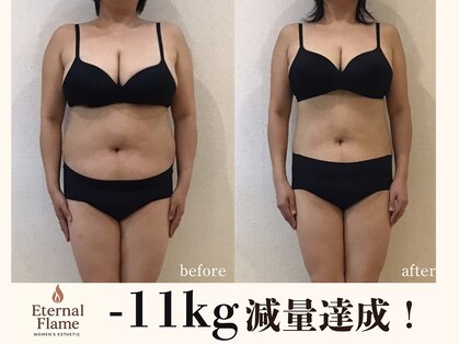 エターナルフレーム(Eternal Flame)の写真