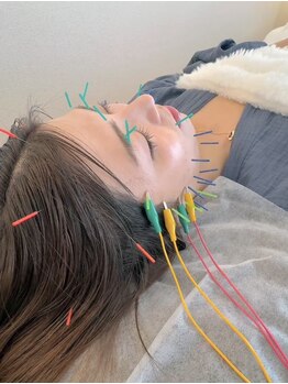 バスト鍼ラボ 代々木上原(BUST 鍼LAB.)の写真/【バストアップ×根本改善】美容鍼で全身の巡りを整え、肩こり/慢性疲労を解消しながら上向きバストを実現
