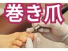 【毎月5名様限定】巻き爪,陥入爪に対応☆初回限定カウンセリング込み¥9,680