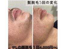 メロス