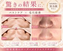 ローズドゥシャロン(Rose de CHALON)