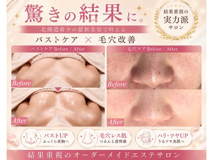 ローズドゥシャロン(Rose de CHALON)の写真
