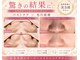 ローズドゥシャロン(Rose de CHALON)の写真