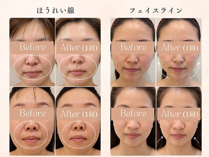 アトリエ コガオ(Atelier Kogao)の写真