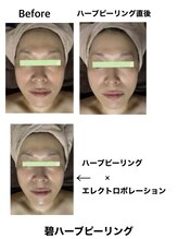 サロン ド ヴィーナス ビューティー(salon de Venus beaute)/美白/ツヤ/引締め