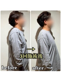 全力ストレッチ 川口店/before/after 1 SUZUKA