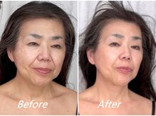 ドクターボディ 新宿店(Dr.Body)/【首長/フェイスライン　50代】